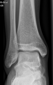 Thumb d4doc formularer upload 2014 11 ankelled 20ap