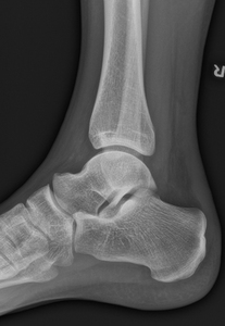 Thumb d4doc formularer upload 2014 11 ankelled 20lat